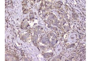 IHC analysis of Beta 2 Microglobulin using anti-Beta 2 Microglobulin antibody (ABIN6719452). (beta-2 Microglobulin anticorps  (AA 22-119))