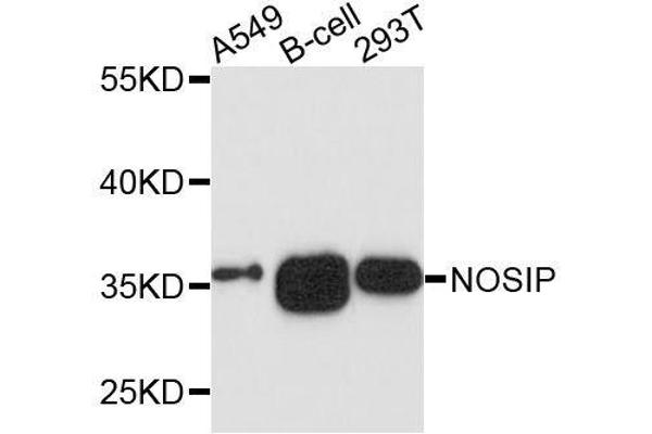 NOSIP antibody  (AA 1-301)