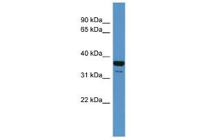 WB Suggested Anti-CD200R1 Antibody Titration: 0.
