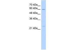 WB Suggested Anti-GINS1 Antibody Titration:  5. (GINS1 anticorps  (N-Term))