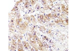 Immunohistochemistry of paraffin-embedded Human liver using CYP3A4 Polyclonal Antibody at dilution of 1:100 (40x lens). (CYP3A4 anticorps)