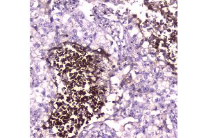 IHC analysis of Lactoferrin using anti-Lactoferrin antibody .