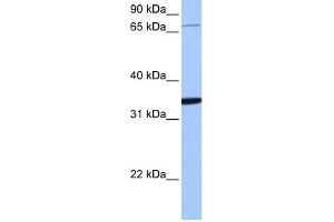WB Suggested Anti-PCDHA10 Antibody Titration:  0. (PCDHA10 anticorps  (N-Term))