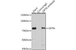 Immunoprecipitation analysis of 25 μg extracts of Mouse heart cells using 3 μg OPTN antibody (ABIN3015612, ABIN3015613, ABIN3015614 and ABIN6218972). (OPTN anticorps  (AA 1-577))