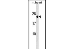 HOXB7 Antibody (Center) (ABIN1538701 and ABIN2838284) western blot analysis in mouse heart tissue lysates (35 μg/lane). (HOXB7 anticorps  (AA 93-121))