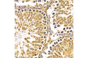 Immunohistochemistry of paraffin-embedded Rat testis using PIBF1 antibody at dilution of 1:100 (x400 lens). (PIBF1 anticorps)