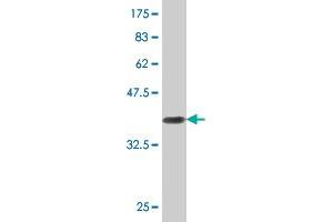 Western Blot detection against Immunogen (37.