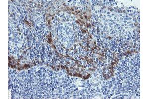 Image no. 3 for anti-Alcohol Dehydrogenase 7 (Class IV), mu Or sigma Polypeptide (ADH7) antibody (ABIN1496481)