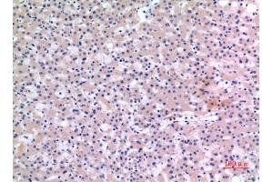 Immunohistochemical analysis of paraffin-embedded human-liver, antibody was diluted at 1:100. (CMTM6 anticorps  (C-Term))