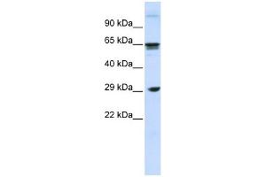 CLEC4M antibody used at 1 ug/ml to detect target protein. (C-Type Lectin Domain Family 4, Member M (CLEC4M) (N-Term) anticorps)