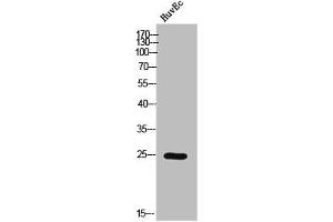 Western Blot analysis of HuvEc cells using Phospho-Casein Kinase IIβ (S209) Polyclonal Antibody (CSNK2B anticorps  (pSer209))
