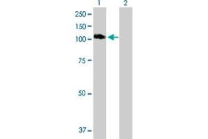Western Blot analysis of STAT6 expression in transfected 293T cell line by STAT6 MaxPab polyclonal antibody. (STAT6 anticorps  (AA 1-847))