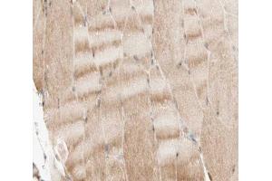 ABIN6266499 at 1/200 staining human skeletal muscle tissue sections by IHC-P.