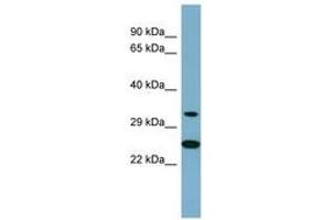 Image no. 1 for anti-Protein Kinase, AMP-Activated, beta 2 Non-Catalytic Subunit (PRKAB2) (AA 179-228) antibody (ABIN6741851)