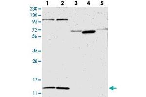 Western blot analysis of Lane 1: RT-4, Lane 2: U-251 MG, Lane 3: Human Plasma, Lane 4: Liver, Lane 5: Tonsil with MRPL52 polyclonal antibody  at 1:250-1:500 dilution.
