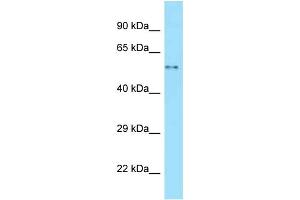 WB Suggested Anti-WASL Antibody Titration: 1. (Neural Wiskott-Aldrich syndrome protein (WASL) (Middle Region) anticorps)