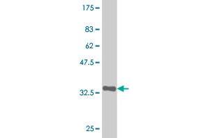 Western Blot detection against Immunogen (35. (ZSCAN21 anticorps  (AA 136-224))