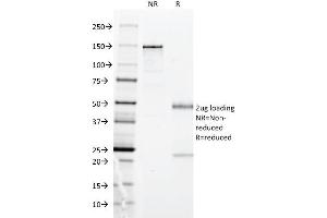 SDS-PAGE Analysis Purified HLA-DP Mouse Monoclonal Antibody (BRA-FB6). (HLA-DPB1 anticorps)