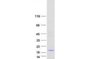 Validation with Western Blot