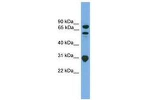 Image no. 1 for anti-SH3-Domain Kinase Binding Protein 1 (SH3KBP1) (AA 107-156) antibody (ABIN6745063) (SH3KBP1 anticorps  (AA 107-156))