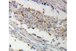 Used in DAB staining on fromalin fixed paraffin-embedded ovary tissue (AKAP12 anticorps  (AA 1485-1782))