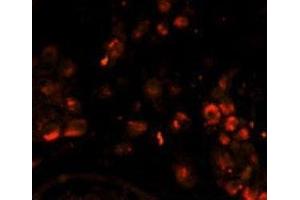 Immunofluorescence analysis of LIN28A antibody with paraffin-embedded human testis tissue. (LIN28A anticorps)