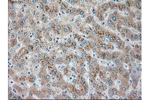 Immunohistochemical staining of paraffin-embedded pancreas tissue using anti-SERPINA1mouse monoclonal antibody. (SERPINA1 anticorps)