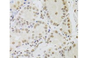 Immunohistochemistry of paraffin-embedded Human stomach using RUVBL1 Polyclonal Antibody at dilution of 1:100 (40x lens). (RUVBL1 anticorps)