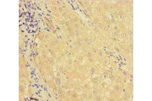 Immunohistochemistry of paraffin-embedded human liver tissue using ABIN7158728 at dilution of 1:100 (KDM1B anticorps  (AA 451-544))