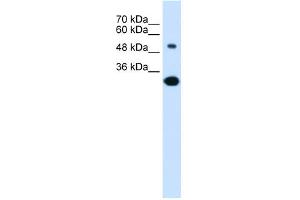 WB Suggested Anti-SLC2A5 Antibody Titration:  0. (SLC2A5 anticorps  (Middle Region))