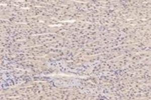 Immunohistochemistry analysis of paraffin-embedded mouse kidney using,PFDN4 (ABIN7075171) at dilution of 1: 4200 (PFDN4 anticorps)