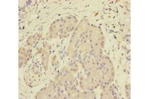 Immunohistochemistry of paraffin-embedded human pancreatic tissue using ABIN7168641 at dilution of 1:100 (SCFD1 anticorps  (AA 373-642))