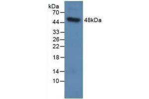 Detection of Recombinant SPC, Human using Polyclonal Antibody to Surfactant Protein C (SP-C) (Surfactant Protein C anticorps  (AA 24-197))