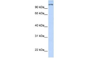 Western Blotting (WB) image for anti-Poly (ADP-Ribose) Polymerase Family, Member 9 (PARP9) antibody (ABIN2458048) (PARP9 anticorps)