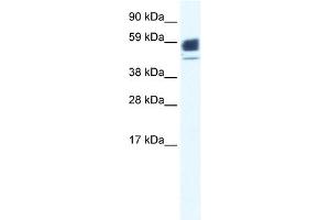 WB Suggested Anti-CHRNA1 Antibody Titration:  0. (CHRNA1 anticorps  (N-Term))