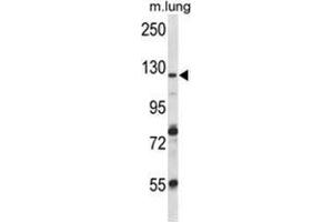 VPS54 Antibody (Center) western blot analysis in mouse lung tissue lysates (35 µg/lane). (VPS54 anticorps  (Middle Region))