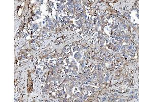 IHC analysis of EHD3 using anti-EHD3 antibody (ABIN7602777). (EHD3 anticorps  (C-Term))