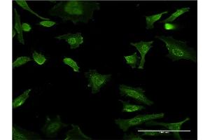Immunofluorescence of monoclonal antibody to KLF4 on HeLa cell.