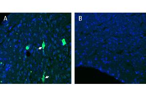 anti-Bradykinin Receptor B1 (BDKRB1) (AA 202-214), (Extracellular), (Loop 2) antibody