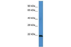 Host: Rabbit Target Name: MSRA Sample Type: HT1080 Whole Cell lysates Antibody Dilution: 1. (MSRA anticorps  (Middle Region))