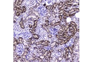 IHC testing of FFPE mouse kidney tissue with Carboxylesterase 1 antibody at 1ug/ml.