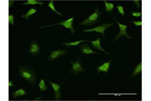 Immunofluorescence of monoclonal antibody to RING1 on HeLa cell.