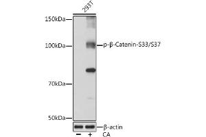 Western blot analysis of extracts of 293T cells, using Phospho-β-Catenin-S33/S37 Rabbit mAb (ABIN7266140) at 1:1000 dilution.