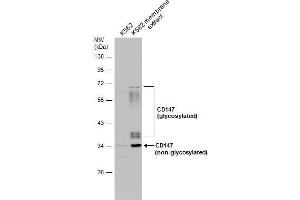 WB Image K562 whole cell and membrane extracts (30 μg) were separated by 10% SDS-PAGE, and the membrane was blotted with CD147 antibody [N2C3] , diluted at 1:500. (CD147 anticorps)