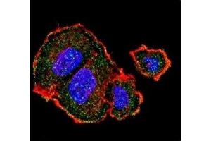 Confocal immunofluorescent analysis of p-Tuberin antibody with MCF-7 cells followed by Alexa Fluor 488-conjugated goat anti-rabbit lgG (green).