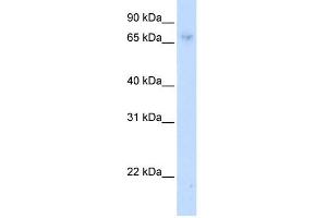 WB Suggested Anti-ZNF432 Antibody Titration:  0. (ZNF432 anticorps  (C-Term))