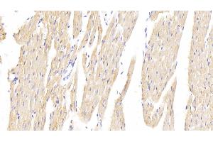Detection of HMGCR in Rat Cardiac Muscle Tissue using Polyclonal Antibody to 3-Hydroxy-3-Methylglutaryl Coenzyme A Reductase (HMGCR) (HMGCR anticorps  (AA 638-887))
