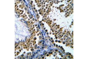 Immunohistochemical analysis of Topoisomerase 2 beta staining in human tonsil formalin fixed paraffin embedded tissue section. (TOP2B anticorps  (N-Term))