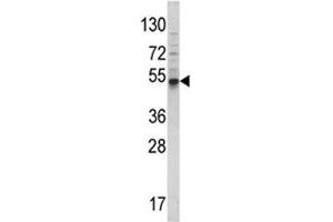 Western blot analysis of BMP3 antibody and 293 lysate.