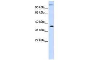 Image no. 1 for anti-Dihydrodiol Dehydrogenase (Dimeric) (DHDH) (AA 252-301) antibody (ABIN6741277) (DHDH anticorps  (AA 252-301))